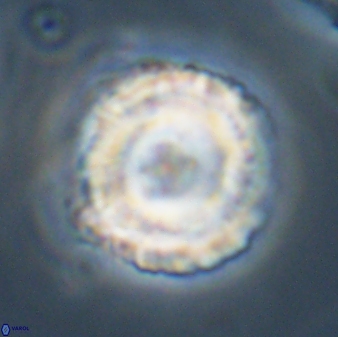 Bomolithus cantabriae 58496