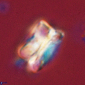 Bomolithus cantabriae 58500
