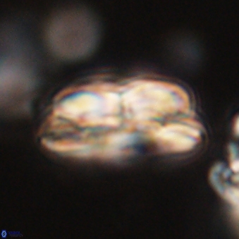 Bomolithus dydimolofous 70637