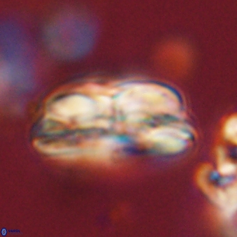 Bomolithus dydimolofous 70637