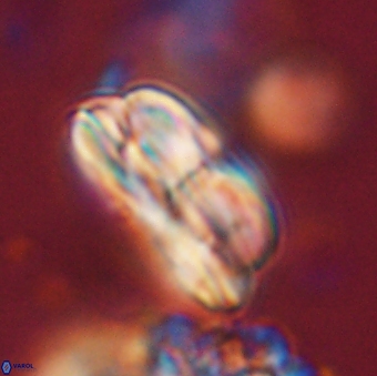 Bomolithus dydimolofous 70637