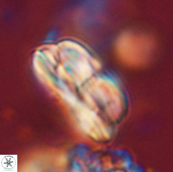 Bomolithus dydimolofous 70637