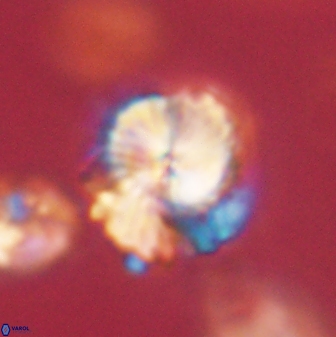 Bomolithus elegans 62339