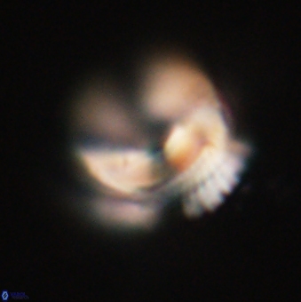 Bomolithus falklandensis 20536