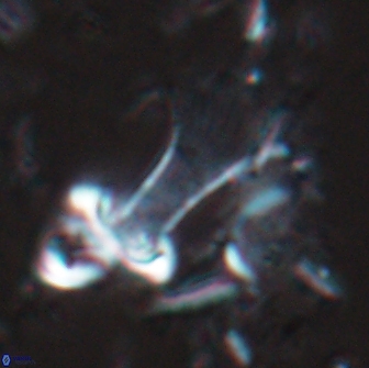 Boletuvelum candens 16335