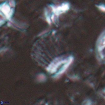 Boletuvelum phossonos 16170