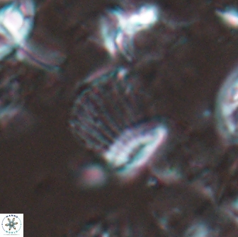 Boletuvelum phossonos 16170