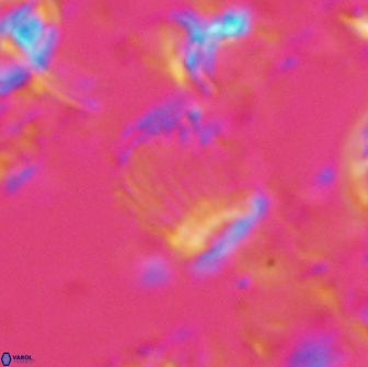 Boletuvelum phossonos 16171