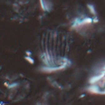 Boletuvelum phossonos 16172