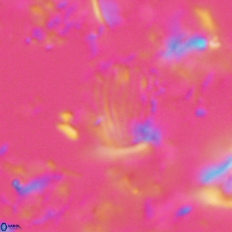 Boletuvelum phossonos 16173