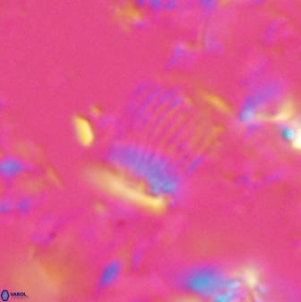 Boletuvelum phossonos 16177