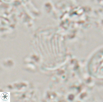 Boletuvelum phossonos 16178
