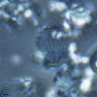 Boletuvelum phossonos 16179