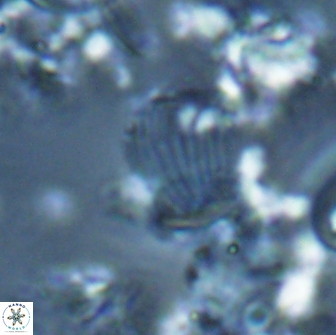 Boletuvelum phossonos 16179