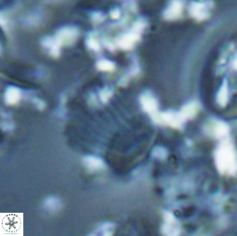 Boletuvelum phossonos 16181