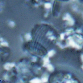 Boletuvelum phossonos 16182