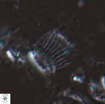 Boletuvelum phossonos 16215