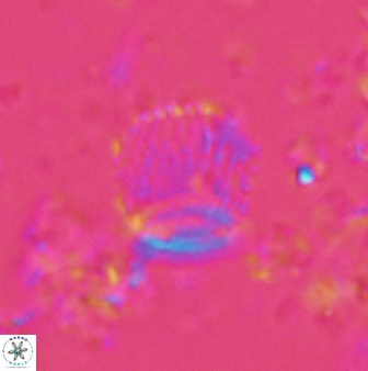 Boletuvelum phossonos 16218