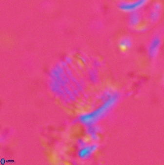 Boletuvelum phossonos 16220