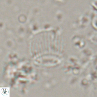 Boletuvelum phossonos 16221