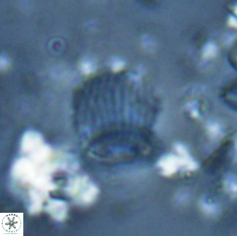 Boletuvelum phossonos 16222
