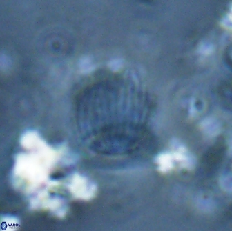 Boletuvelum phossonos 16223