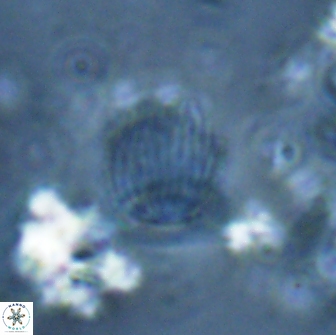 Boletuvelum phossonos 16223
