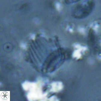 Boletuvelum phossonos 16225