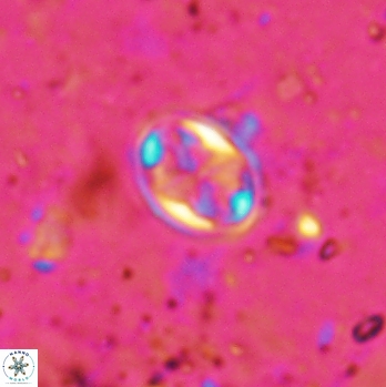 Aktasia irregularis 5787