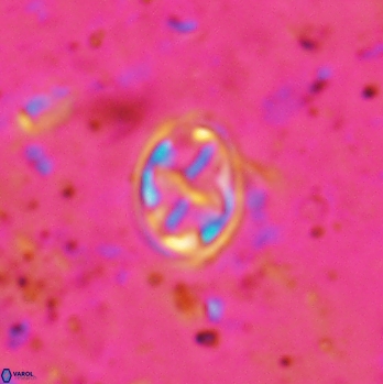 Aktasia irregularis 5789