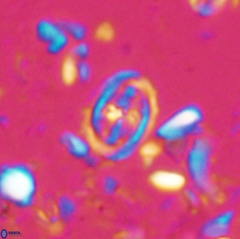 Bownia bilenii 17504