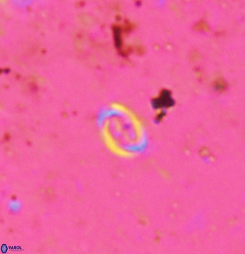 Bownia speiroeidis 5942