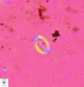 Bownia speiroeidis 5942