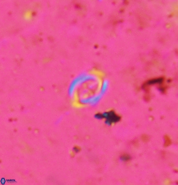 Bownia speiroeidis 5946