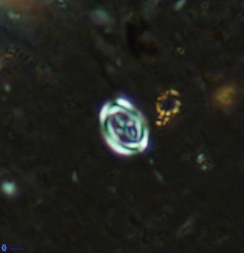 Bownia speiroeidis 5947