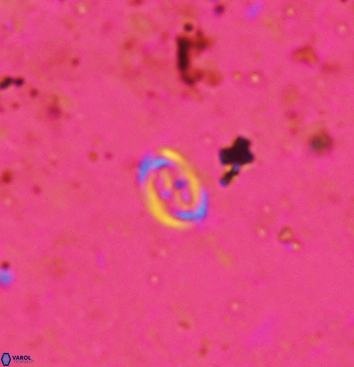 Bownia speiroeidis 5948