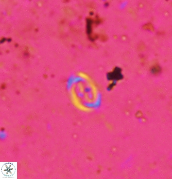 Bownia speiroeidis 5948