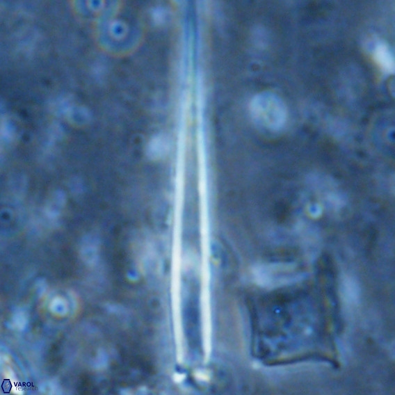 Blackites incompertus VR 02988