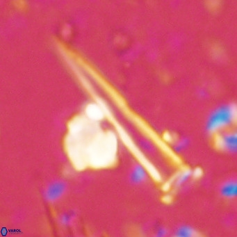 Blackites spinula VR 02889