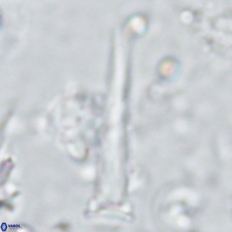 Blackites spinula VR 02893