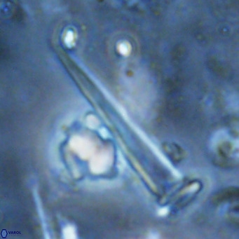 Blackites spinula VR 02895