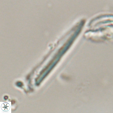 Blackites praeinflatus VR 31274