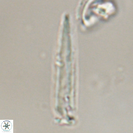 Blackites praeinflatus VR 31273
