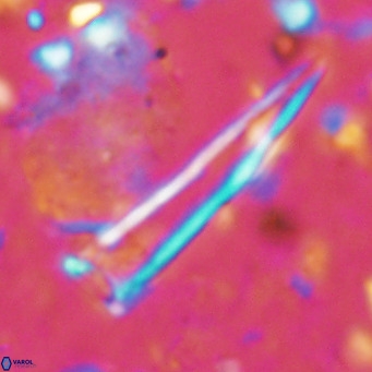 Blackites tenuis VR 02918