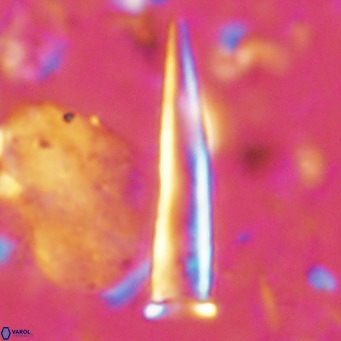 Blackites tenuis VR 02913