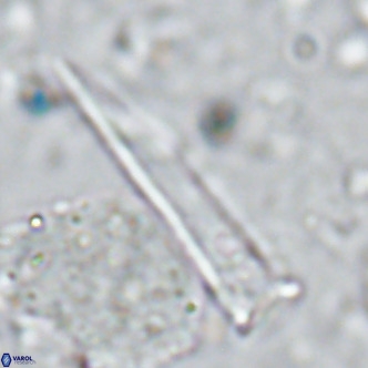 Blackites tenuis VR 02922