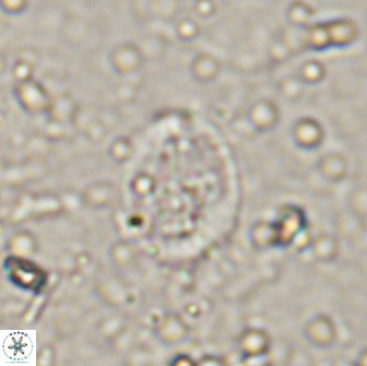 Broinsonia ethmoquadrata 14773