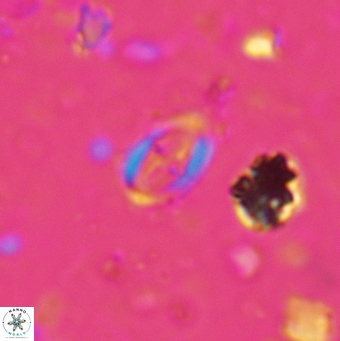 Broinsonia staytonae 5324