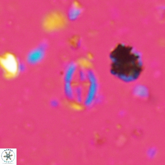 Broinsonia staytonae 5320