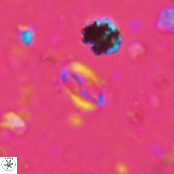 Broinsonia staytonae 5322